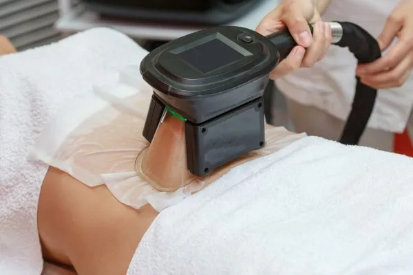 Image of person having fat freezing treatment to help weight gain Smallwood