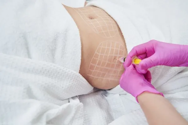 image of fat dissolving injections on love handles to help combat weight gain Smallwood