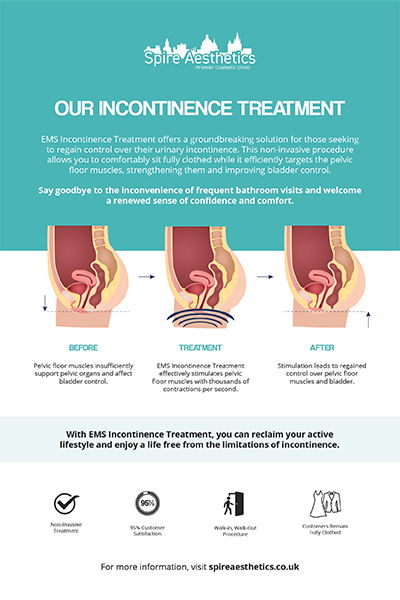 image of how urge incontinence Smallwood treatment works